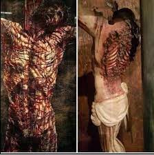 IMPRESSIONTANTE!!! As Chagas de Jesus segundo um cirurgião.